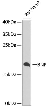 Western blot - BNP Polyclonal Antibody 