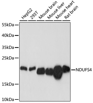 Western blot - NDUFS4 Polyclonal Antibody 