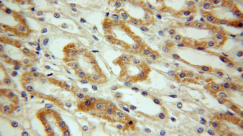 Immunohistochemical of paraffin-embedded human kidney using Catalog No:107466(PFN2 antibody) at dilution of 1:100 (under 40x lens)
