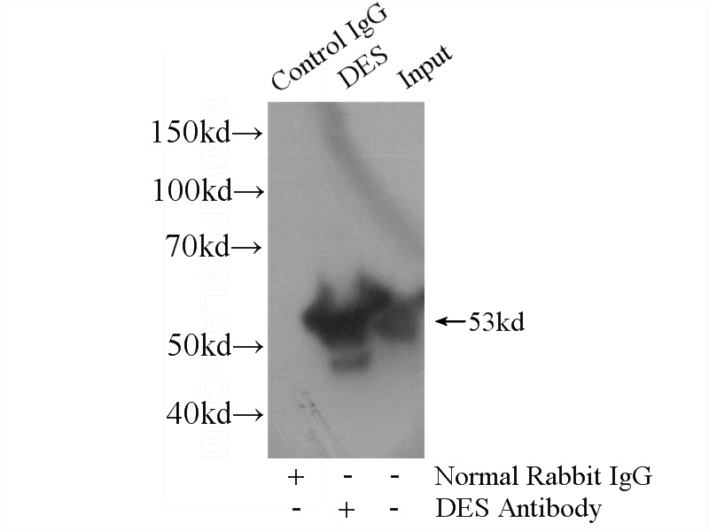 IP Result of anti-Desmin (IP:Catalog No:109897, 4ug; Detection:Catalog No:109897 1:3000) with mouse heart tissue lysate 8000ug.
