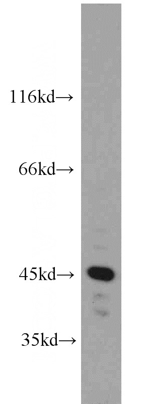 HeLa cells were subjected to SDS PAGE followed by western blot with Catalog No:114195(PRKAR1A antibody) at dilution of 1:500