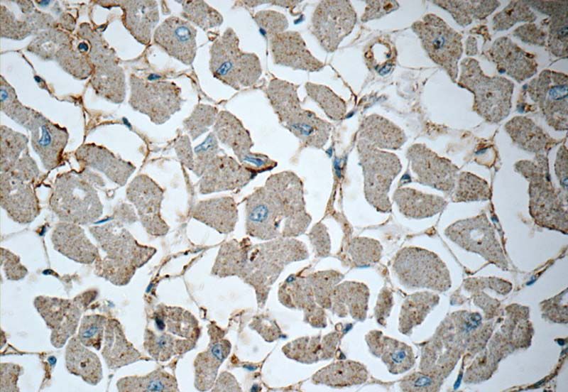 Immunohistochemistry of paraffin-embedded human heart tissue slide using Catalog No:114690 (RENIN-RECEPTOR, ATP6AP2 Antibody) at dilution of 1:50 (under 40x lens)