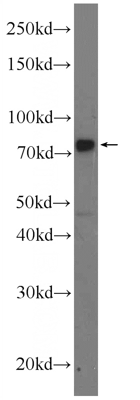 MDA-MB-453s cells were subjected to SDS PAGE followed by western blot with Catalog No:112577(MECP2 Antibody) at dilution of 1:600