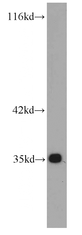 Jurkat cells were subjected to SDS PAGE followed by western blot with Catalog No:107081(Bcl-xL antibody) at dilution of 1:1000