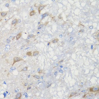 Immunohistochemistry - CHIC2 Polyclonal Antibody 