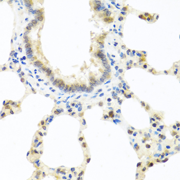 Immunohistochemistry - DEDD Polyclonal Antibody 