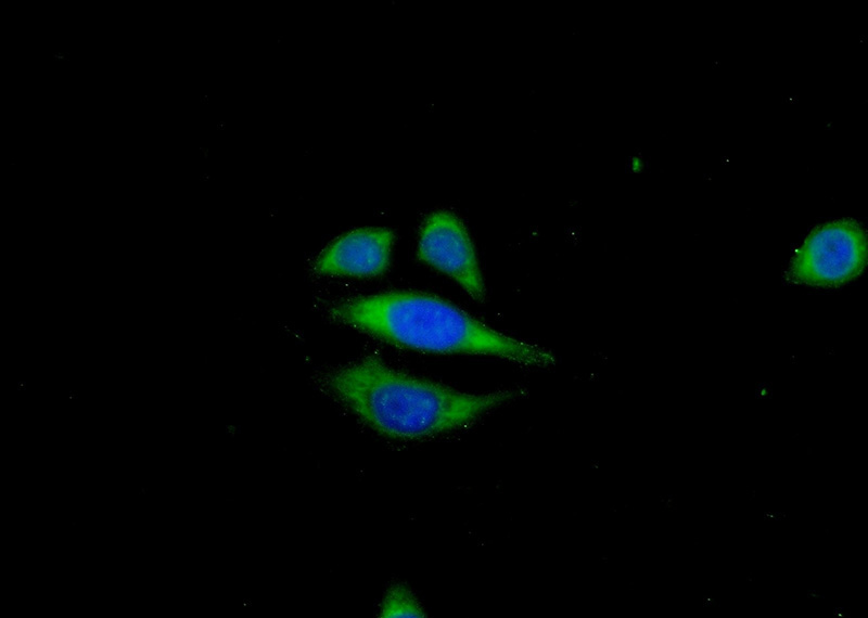 Immunofluorescent analysis of (-20oc Ethanol) fixed PC-3 cells using Catalog No:108076(ANKRD39 Antibody) at dilution of 1:50 and Alexa Fluor 488-congugated AffiniPure Goat Anti-Rabbit IgG(H+L)