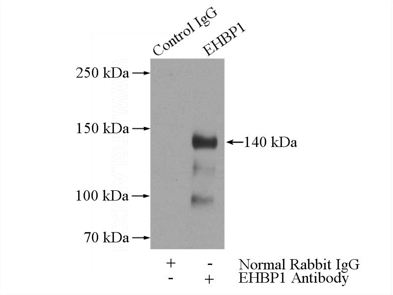 IP Result of anti-EHBP1 (IP:Catalog No:110222, 4ug; Detection:Catalog No:110222 1:500) with mouse liver tissue lysate 4000ug.