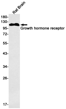 Western blot detection of Growth hormone receptor in Rat Brain lysates using Growth hormone receptor Rabbit mAb(1:500 diluted).Predicted band size:72kDa.Observed band size:120kDa.