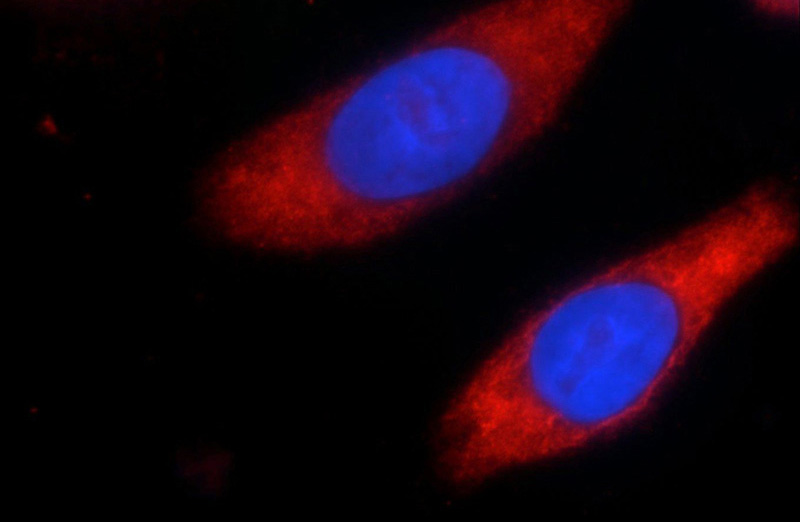 Immunofluorescent analysis of HeLa cells using Catalog No:110939(GEMIN5 Antibody) at dilution of 1:25 and Rhodamine-Goat anti-Rabbit IgG