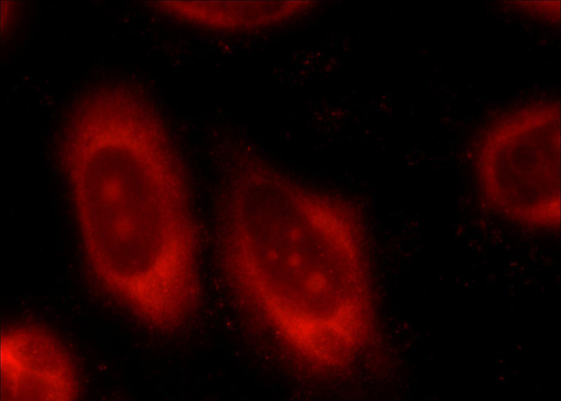 Immunofluorescent analysis of HeLa cells using Catalog No:114145(PPP1CC Antibody) at dilution of 1:25 and Rhodamine-Goat anti-Rabbit IgG