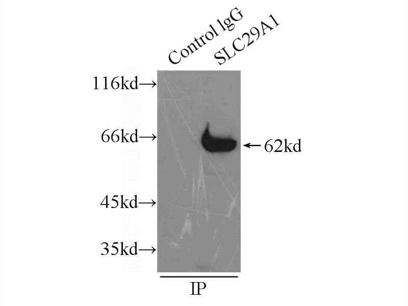 IP Result of anti-ENT1 (IP:Catalog No:110328, 3ug; Detection:Catalog No:110328 1:400) with mouse brain tissue lysate 8000ug.