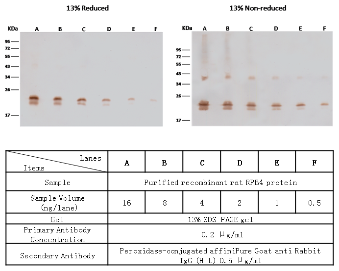 RBP4 Antibody, Rabbit PAb, Antigen Affinity Purified, Western blot