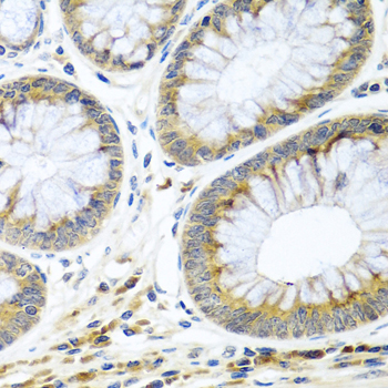 Immunohistochemistry - WNT9A Polyclonal Antibody 