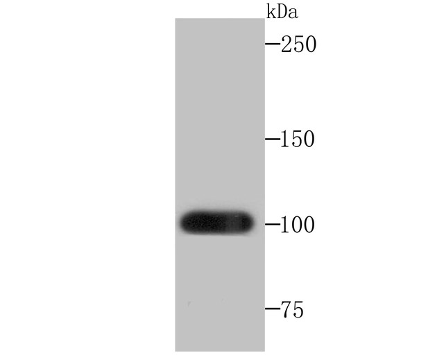 Fig1:; Western blot analysis of Frizzled 8 on mouse lung tissue lysates. Proteins were transferred to a PVDF membrane and blocked with 5% BSA in PBS for 1 hour at room temperature. The primary antibody ( 1/500) was used in 5% BSA at room temperature for 2 hours. Goat Anti-Rabbit IgG - HRP Secondary Antibody (HA1001) at 1:200,000 dilution was used for 1 hour at room temperature.