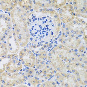 Immunohistochemistry - BNIP3 Polyclonal Antibody 