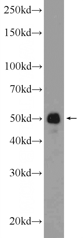 U-937 cells were subjected to SDS PAGE followed by western blot with Catalog No:115628(ST6GAL1 Antibody) at dilution of 1:600