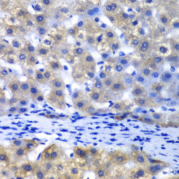 Immunohistochemistry - PSMD8 Polyclonal Antibody 