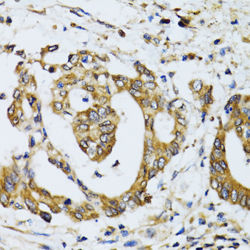 Immunohistochemistry - RPN1 Polyclonal Antibody 