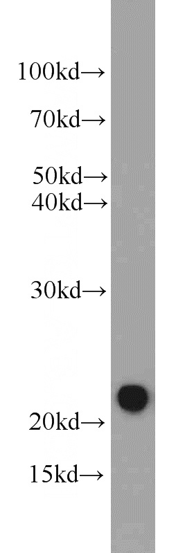 mouse liver tissue were subjected to SDS PAGE followed by western blot with Catalog No:109609(CSRP2 antibody) at dilution of 1:1000