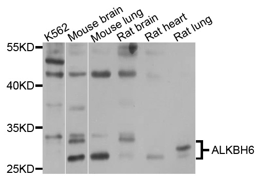 Western blot - ALKBH6 Polyclonal Antibody 
