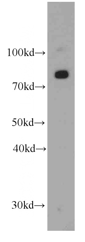 L02 cells were subjected to SDS PAGE followed by western blot with Catalog No:107173(CPT1A antibody) at dilution of 1:500