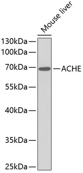 Western blot - ACHE Polyclonal Antibody 