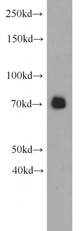 mouse heart tissue were subjected to SDS PAGE followed by western blot with Catalog No:115103(SEMA3C antibody) at dilution of 1:500