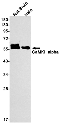 Western blot detection of CaMKII alpha in Rat Brain,Hela cell lysates using CaMKII alpha Rabbit pAb(1:1000 diluted).Predicted band size:54kDa.Observed band size:54kDa.