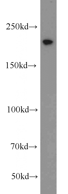 HeLa cells were subjected to SDS PAGE followed by western blot with Catalog No:115914(TCOF1 antibody) at dilution of 1:1000