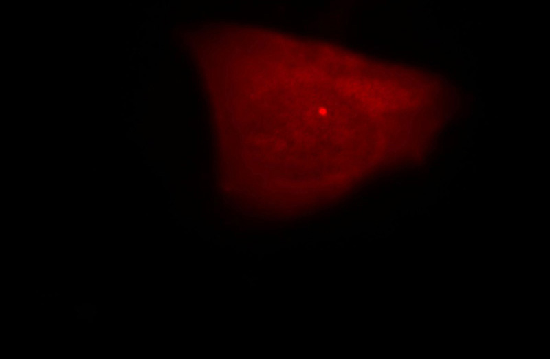 Immunofluorescent analysis of Hela cells, using CEP170L antibody Catalog No:109268 at 1:25 dilution and Rhodamine-labeled goat anti-rabbit IgG (red).