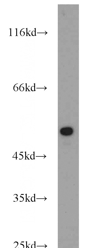 mouse skin tissue were subjected to SDS PAGE followed by western blot with Catalog No:109793(KRT14 antibody) at dilution of 1:1000