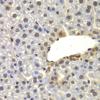 Immunohistochemistry - SUPT20H Polyclonal Antibody 