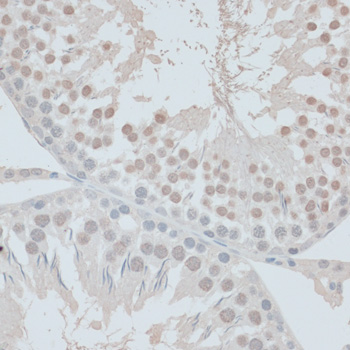 Immunohistochemistry - ZNF446 Polyclonal Antibody 