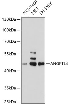 Western blot - ANGPTL4 Polyclonal Antibody 