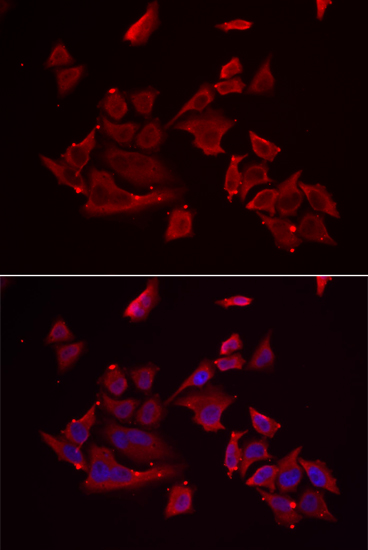Immunofluorescence - RARRES2 Polyclonal Antibody 