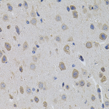 Immunohistochemistry - SUMO3 Polyclonal Antibody 