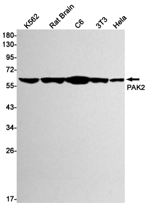 Western blot detection of PAK2 in K562,Rat Brain,C6,3T3,Hela cell lysates using PAK2 Rabbit mAb(1:1000 diluted).Predicted band size:58kDa.Observed band size:58kDa.