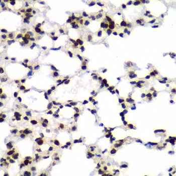 Immunohistochemistry - TEAD1 Polyclonal Antibody 