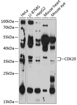 Western blot - CDK20 Polyclonal Antibody 