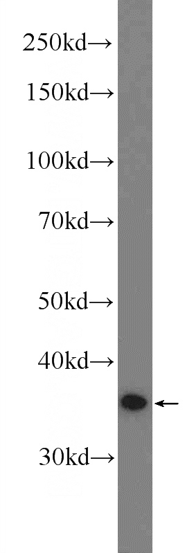HEK-293 cells were subjected to SDS PAGE followed by western blot with Catalog No:112648(MAP2K6 Antibody) at dilution of 1:600