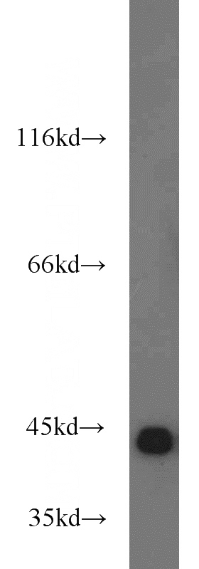 HeLa cells were subjected to SDS PAGE followed by western blot with Catalog No:113911(PINX1 antibody) at dilution of 1:1000