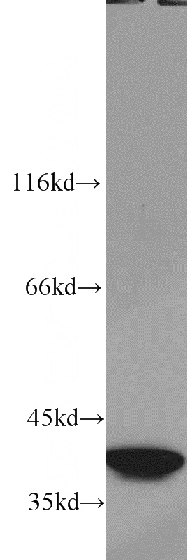 K-562 cells were subjected to SDS PAGE followed by western blot with Catalog No:115394(SMN2 antibody) at dilution of 1:2000