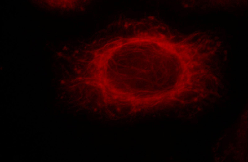 Immunofluorescent analysis of Hela cells, using SHC1 antibody Catalog No:115266 at 1:25 dilution and Rhodamine-labeled goat anti-rabbit IgG (red).