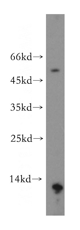 human stomach tissue were subjected to SDS PAGE followed by western blot with Catalog No:112683(MLN antibody) at dilution of 1:4000