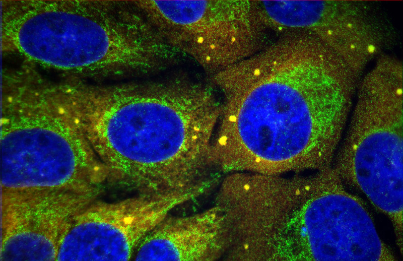 F result of Catalog No:110192(anti-EIF3D) in U2OS cell (treated with 100 mM sodium arsenite to cause stress-induced translational arrest) by Dr. Nancy Kedersha.U2OS cells (FAST-YFP stables; but not showing FAST-YFP); stained with PTG anti-eIF3p66 in green; and counterstained with anti-eIF3b (goat polyclonal) in red; nuclei stained blue using Hoechst.
