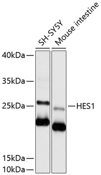Western blot - HES1 Polyclonal Antibody 