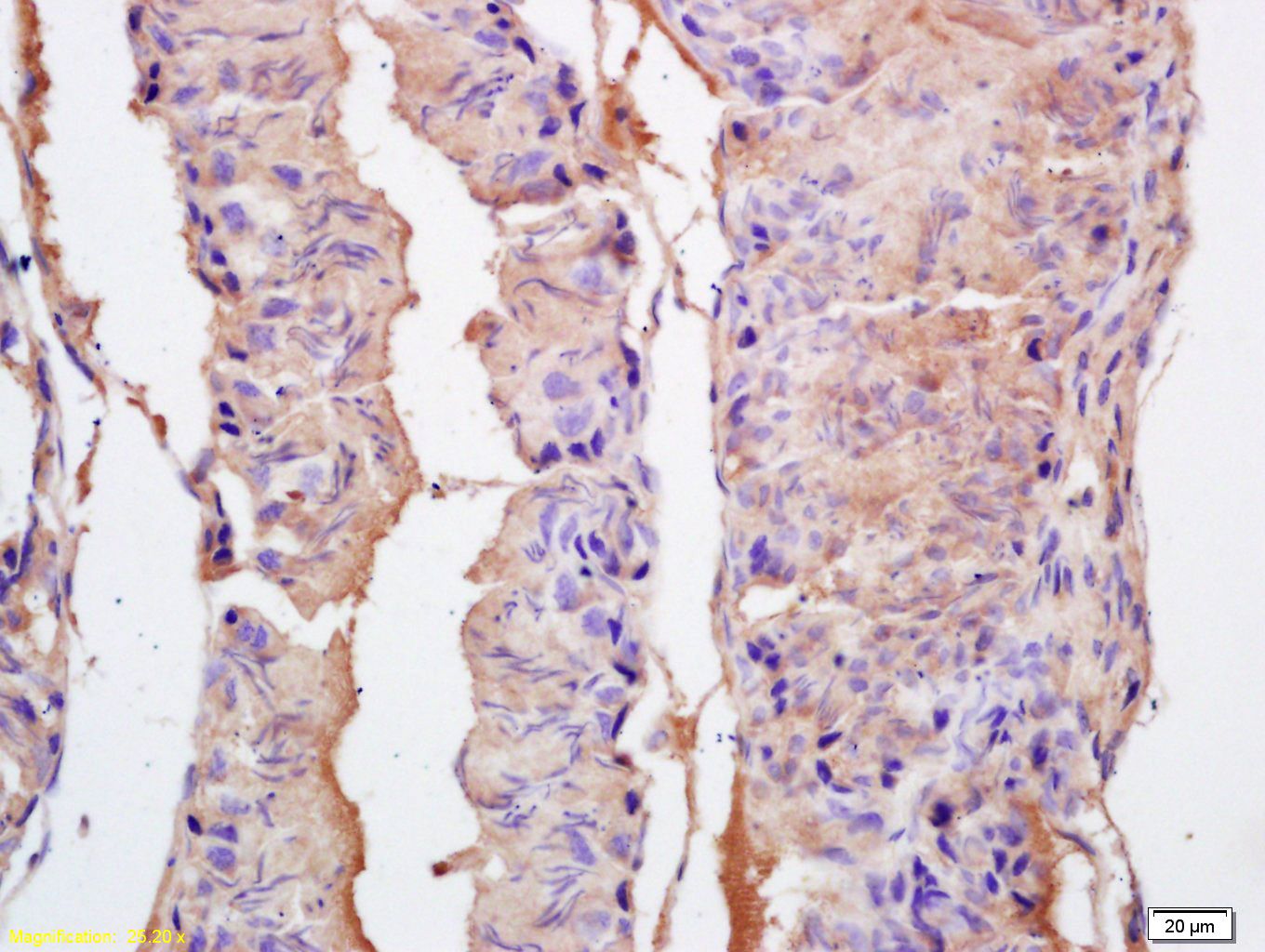 Fig1: Tissue/cell: rat testis tissue; 4% Paraformaldehyde-fixed and paraffin-embedded;; Antigen retrieval: citrate buffer ( 0.01M, pH 6.0 ), Boiling bathing for 15min; Block endogenous peroxidase by 3% Hydrogen peroxide for 30min; Blocking buffer (normal goat serum,C-0005) at 37℃ for 20 min;; Incubation: Anti-EPHA10 Polyclonal Antibody, Unconjugated 1:200, overnight at 4℃, followed by conjugation to the secondary antibody(SP-0023) and DAB(C-0010) staining