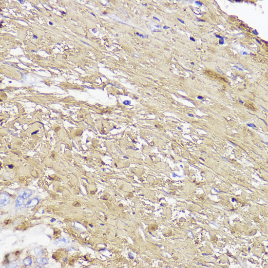 Immunohistochemistry - COL1A1 Polyclonal Antibody 