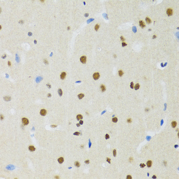Immunohistochemistry - MTA3 Polyclonal Antibody 